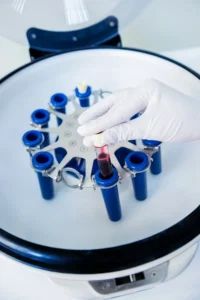 Lipidomic-Testing-Treatment Vials of blood in a testing cylinder. Get Lipidomic testing from Discovery Health Healing Center in Green Bay.